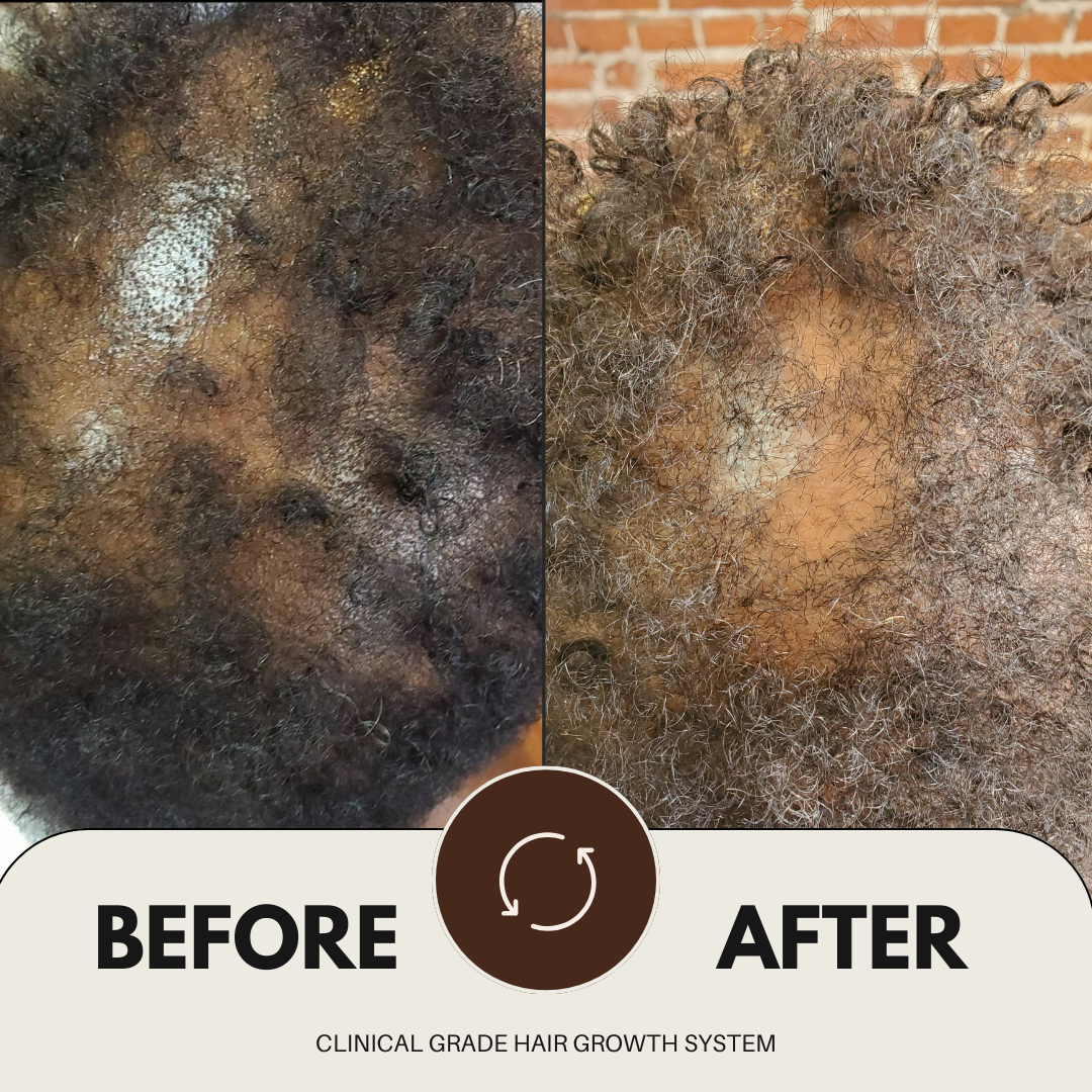 CLINICAL GRADE HAIR GROWTH SYSTEM
