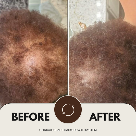 CLINICAL GRADE HAIR GROWTH SYSTEM