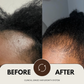 CLINICAL GRADE HAIR GROWTH SYSTEM