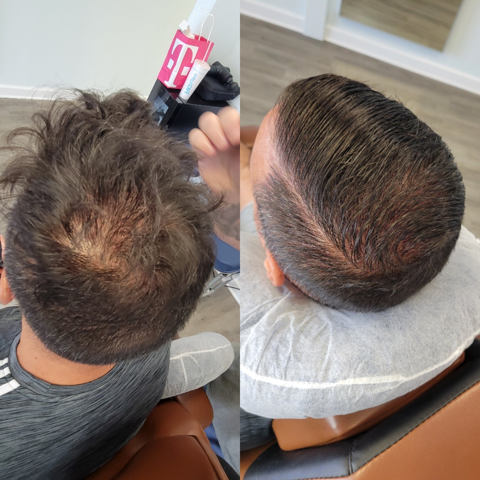 Hair Loss Solutions in Houston Trichologist & Hair Scalp Specialist