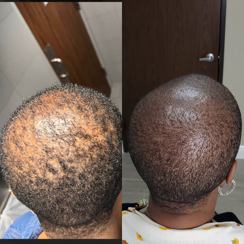 Hair Loss Solutions in Houston Trichologist & Hair Scalp Specialist