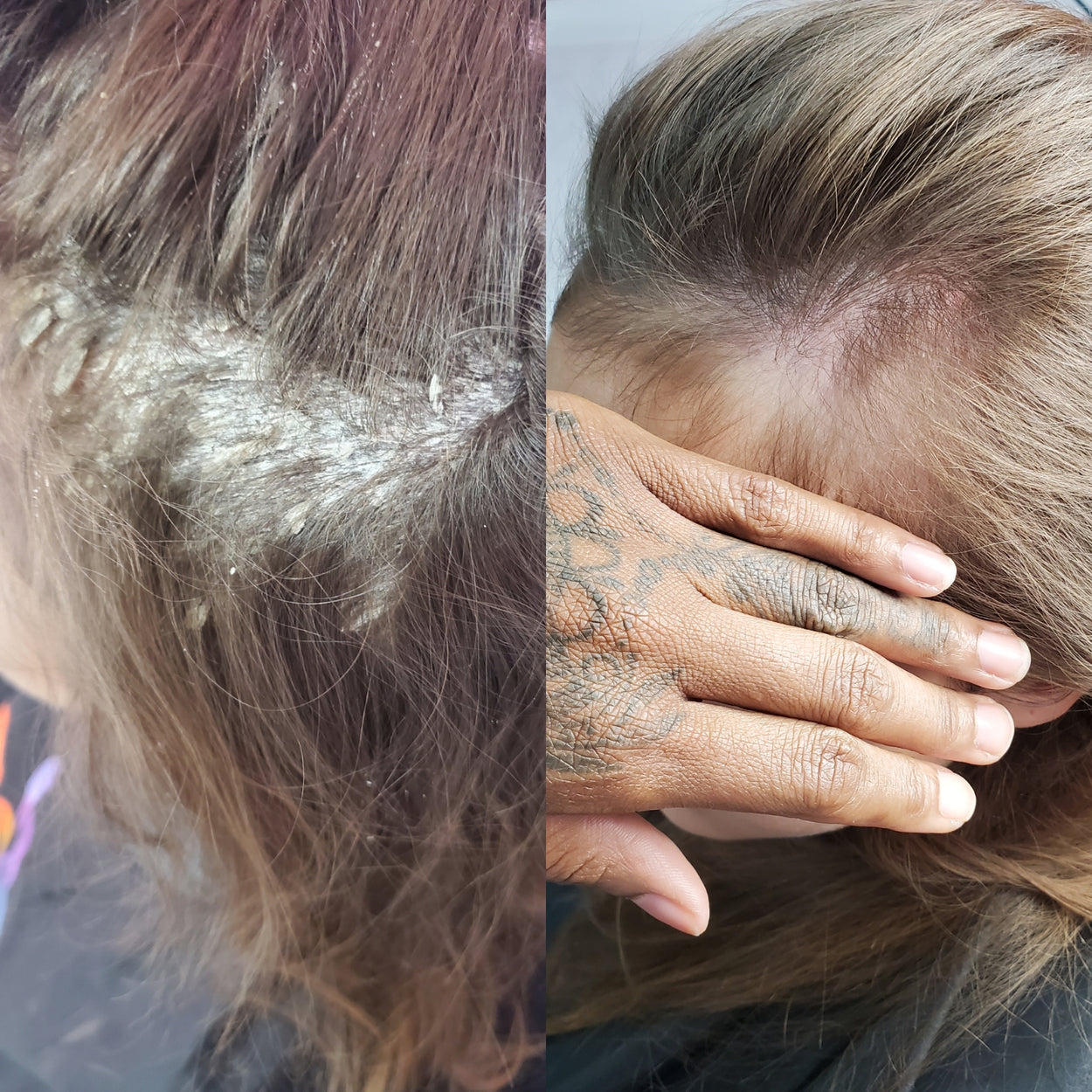 Hair Loss Solutions in Houston Trichologist & Hair Scalp Specialist