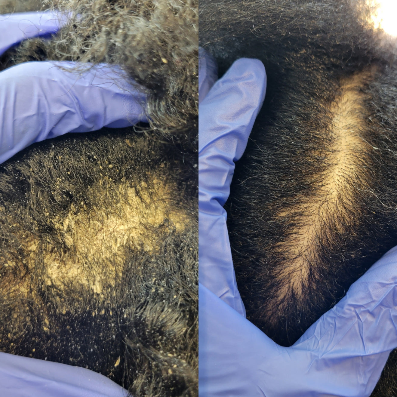 Hair Loss Solutions in Houston Trichologist & Hair Scalp Specialist The Alopecia Doctor Hair