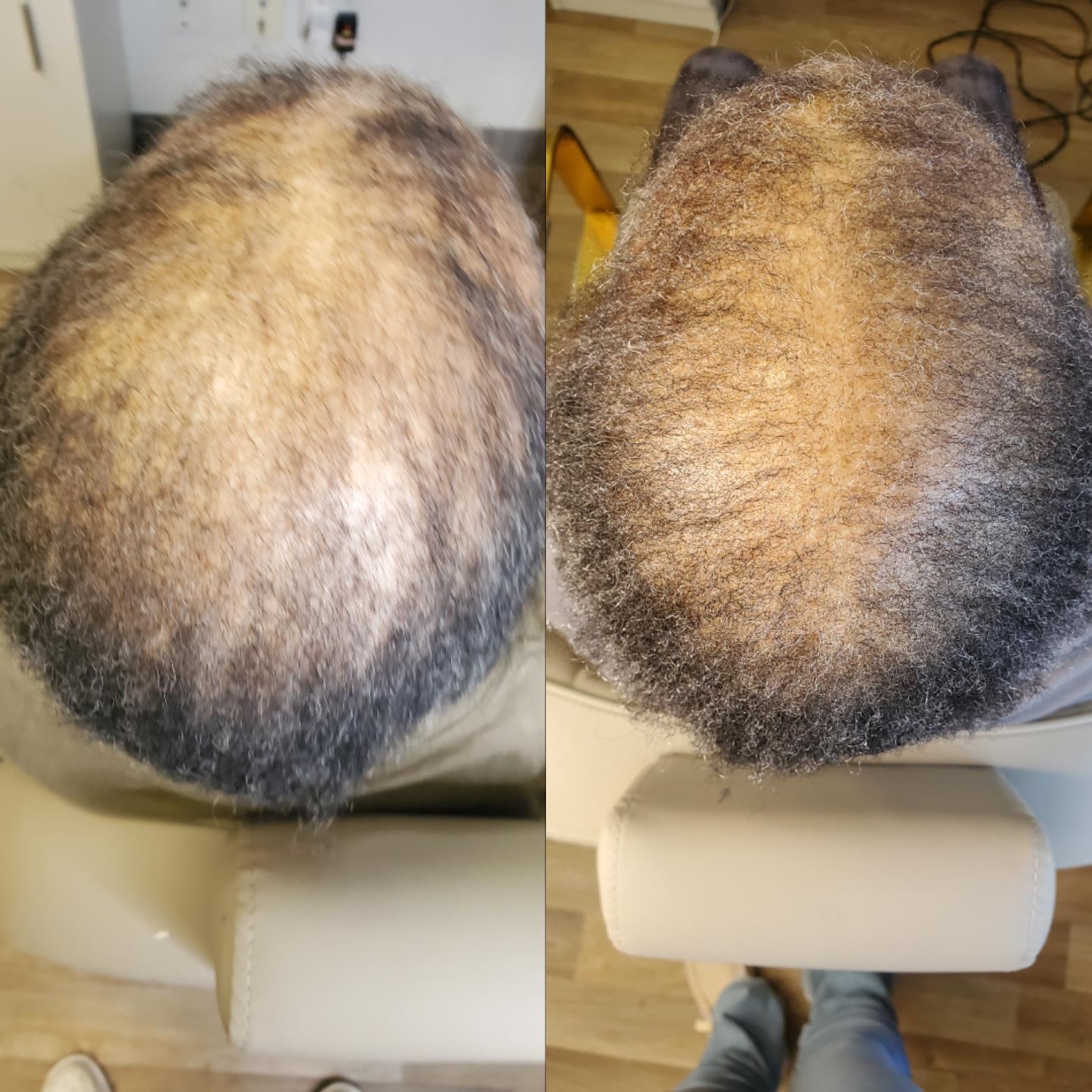 The Alopecia Doctor Hair and Scalp Spa