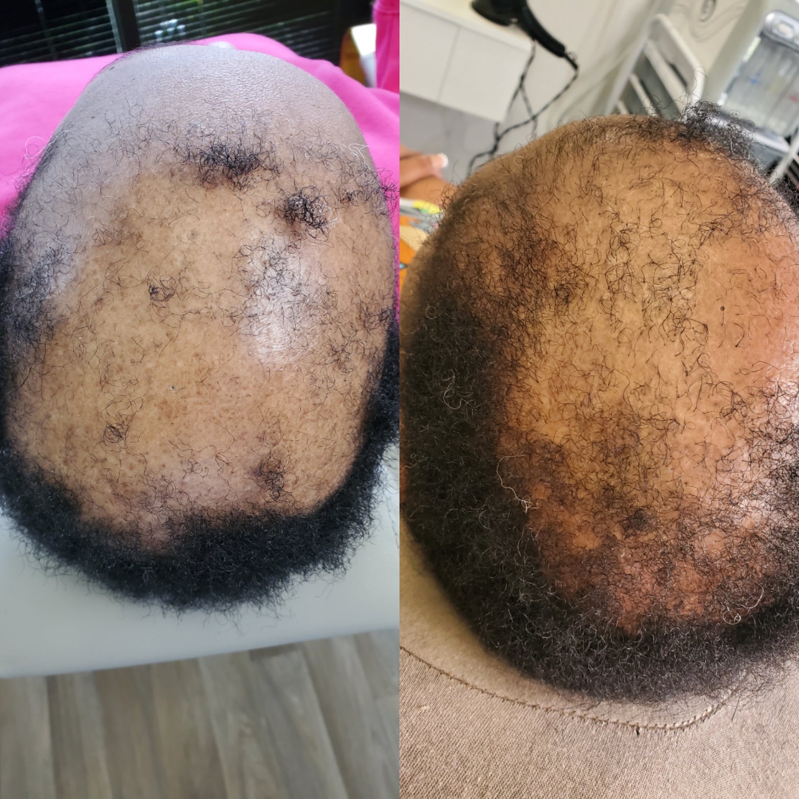 The Alopecia Doctor Hair and Scalp Spa