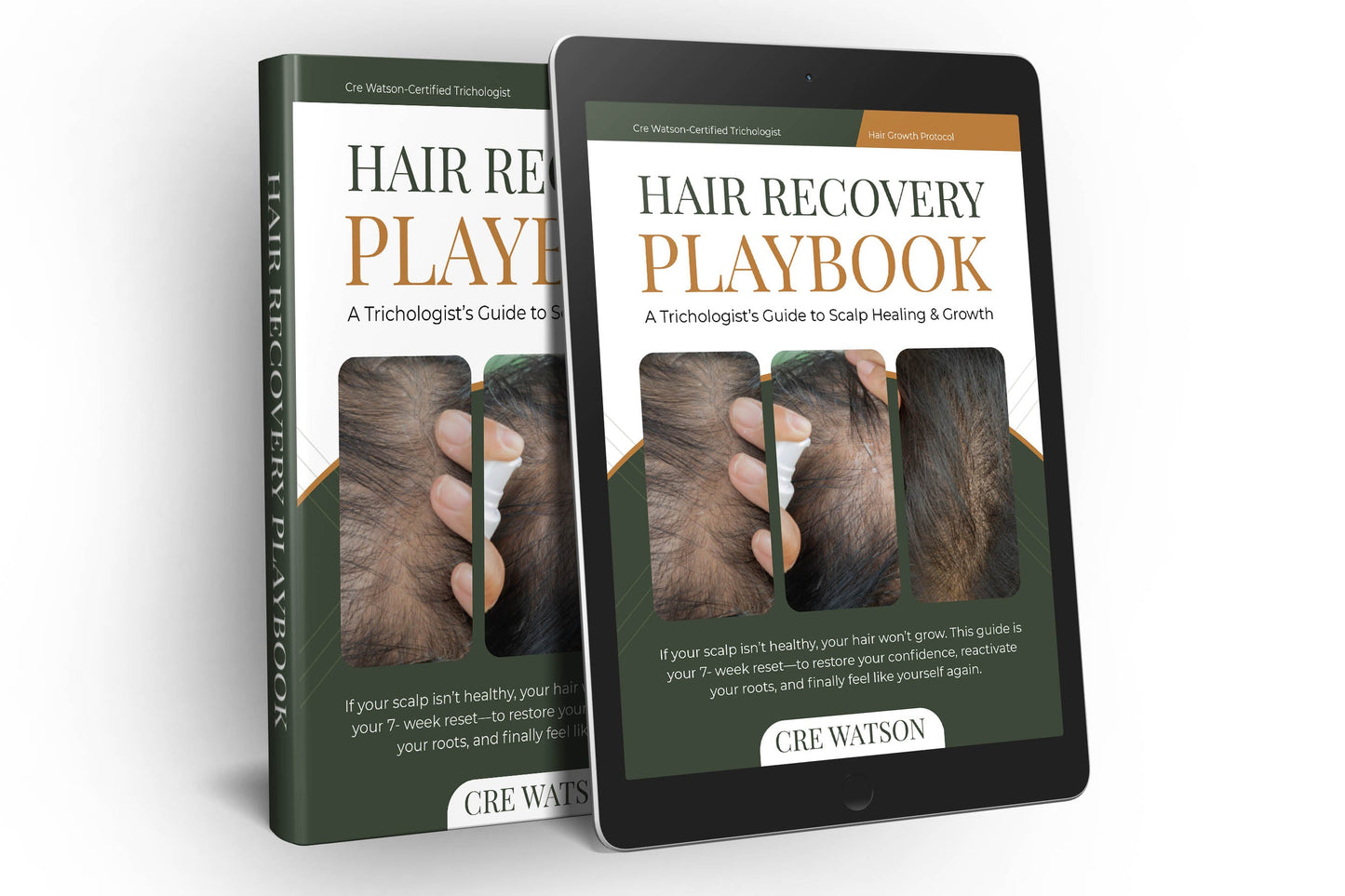 Hair Loss Recovery Guide