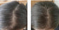 Hair Loss Recovery Kit 7-Week Protocol