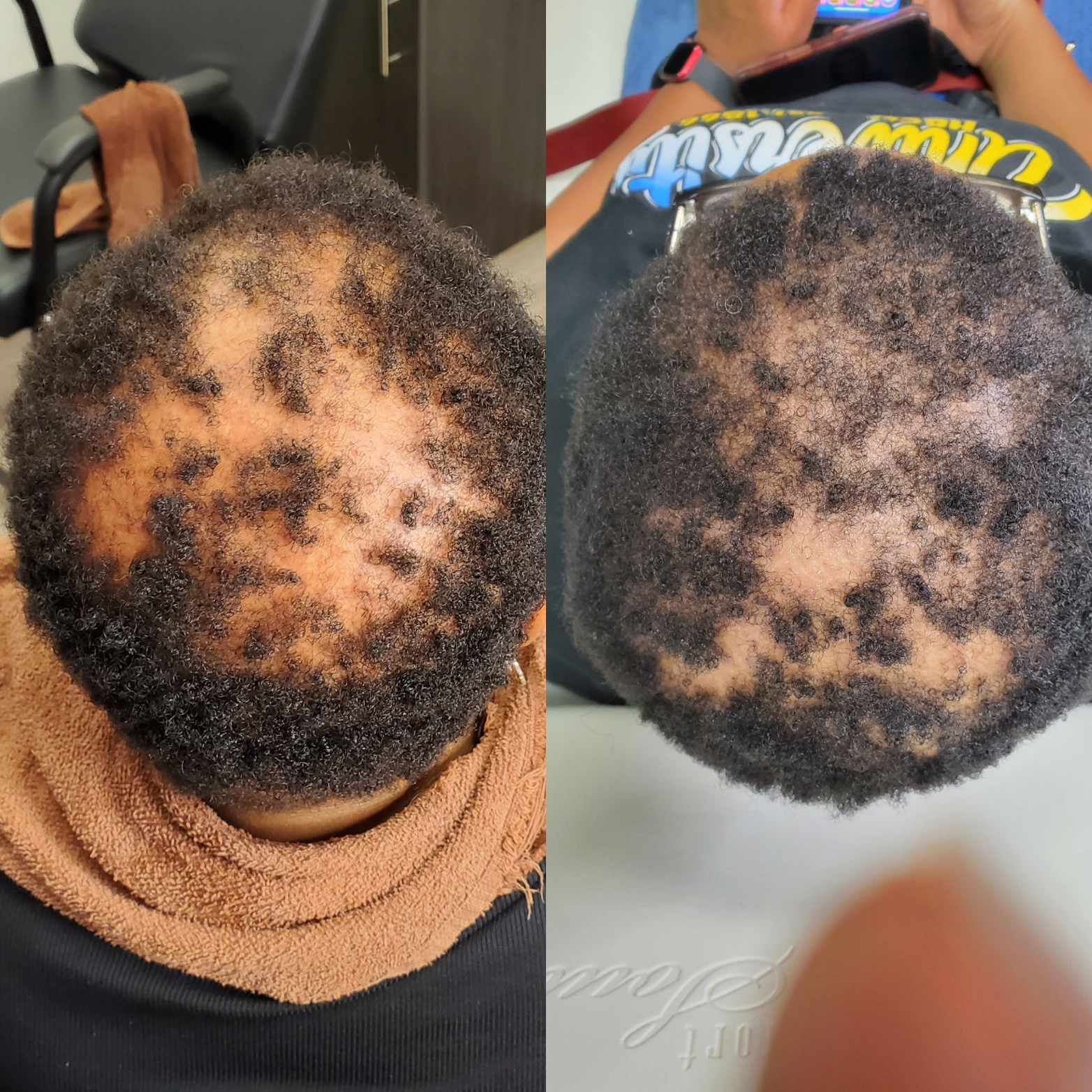 The Alopecia Doctor Hair and Scalp Spa